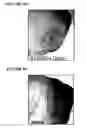Fig. 07 - Compositions and methods for treating cancers associated with ETBR activation