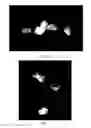 Fig. 03 - Pharmaceutical compositions containing beta-2 microglobulin and methods of treating autoimmune diseases