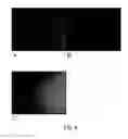 Fig. 04 - Pharmaceutical compositions containing beta-2 microglobulin and methods of treating autoimmune diseases