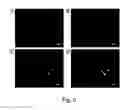 Fig. 05 - Pharmaceutical compositions containing beta-2 microglobulin and methods of treating autoimmune diseases