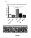 Fig. 04 - TREATMENT OF NEPHROPATHY