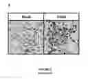 Fig. 05 - TREATMENT OF NEPHROPATHY
