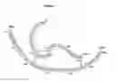 Fig. 05 - Method of treating heart failure with modified relaxin polypeptides