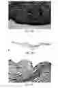 Fig. 09 - RAPID ALLOGRAFT TREATMENT SYSTEMS AND METHODS
