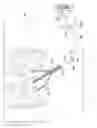 Fig. 02 - Adaptable wound drainage system