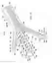 Fig. 04 - Adaptable wound drainage system