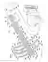 Fig. 12 - Adaptable wound drainage system
