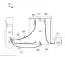Fig. 01 - Tangential flow filter system for the filtration of materials from biologic fluids