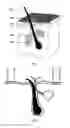 Fig. 07 - Vacuum-assisted drug delivery device and method