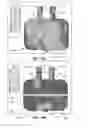 Fig. 32 - Device for retaining humidity in a patient interface