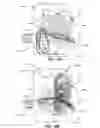 Fig. 34 - Device for retaining humidity in a patient interface