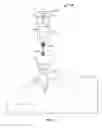 Fig. 02 - APPARATUS FOR DELIVERING AEROSOLIZED MEDICATION