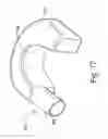 Fig. 16 - Humidifier tub for CPAP device