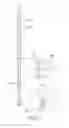 Fig. 11 - Catheter for Portable Lung Assist Device