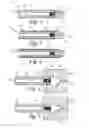 Fig. 02 - Molded catheter tip