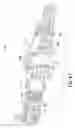 Fig. 41 - Multi-use blood control safety catheter assembly