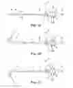 Fig. 02 - Bidirectional steering control apparatus for a catheter