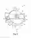 Fig. 10 - Bidirectional steering control apparatus for a catheter