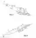 Fig. 07 - Needle capture safety interlock for catheter