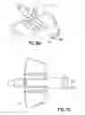 Fig. 34 - Needle capture safety interlock for catheter