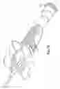 Fig. 36 - Needle capture safety interlock for catheter