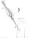 Fig. 57 - Needle capture safety interlock for catheter