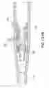 Fig. 61 - Needle capture safety interlock for catheter