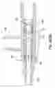 Fig. 64 - Needle capture safety interlock for catheter