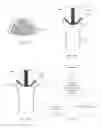 Fig. 07 - Methods and devices to prevent premature birth