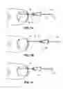 Fig. 02 - Method of treating infections, diseases or disorders of nail unit
