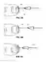 Fig. 04 - Method of treating infections, diseases or disorders of nail unit