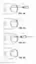 Fig. 06 - Method of treating infections, diseases or disorders of nail unit