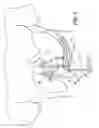 Fig. 08 - Method and Apparatus for Electrical Stimulation of the Pancreatico-Biliary System