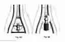 Fig. 09 - Lead anchor with a wedge and systems using the lead anchor