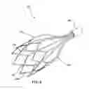 Fig. 04 - Methods and systems for increasing heart contractility by neuromodulation