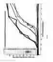 Fig. 22 - Hybrid method for modulating upper airway function in a subject