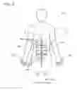 Fig. 05 - ELECTRICAL MUSCLE STIMULATION DEVICE
