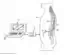Fig. 01 - Neuromodulation system and method for reducing energy requirements using feedback