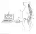 Fig. 01 - Multi-channel neuromodulation system having frequency modulation stimulation
