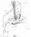 Fig. 06 - Emergency stop with magnetic brake for an exercise device