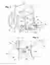 Fig. 02 - Wheelchair accessory for playing soccer