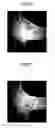 Fig. 06 - Welded structure, laser welding method, and laser welding device