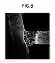 Fig. 07 - Welded structure, laser welding method, and laser welding device