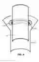 Fig. 04 - Bonded brazing ring system and method for adhering a brazing ring to a tube