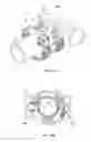 Fig. 13 - Alignment tool for positioning and aligning tubular sections