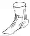 Fig. 01 - Use of additive manufacturing processes in the manufacture of custom wearable and/or implantable medical devices