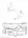 Fig. 02 - Use of additive manufacturing processes in the manufacture of custom wearable and/or implantable medical devices