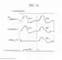 Fig. 12 - Driving circuit for driving a capacitive load