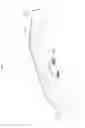 Fig. 22 - Two-stage sway bar