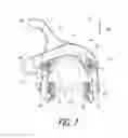 Fig. 08 - Bicycle rim brake